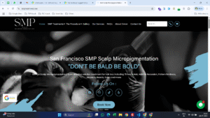 SMP Treatment